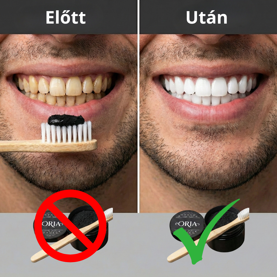 ORIA® - Aktív Szenes Fogfehérítő Por