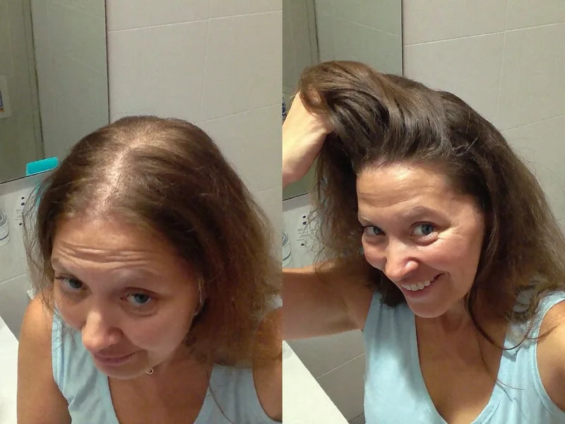Katalin előtte utána
